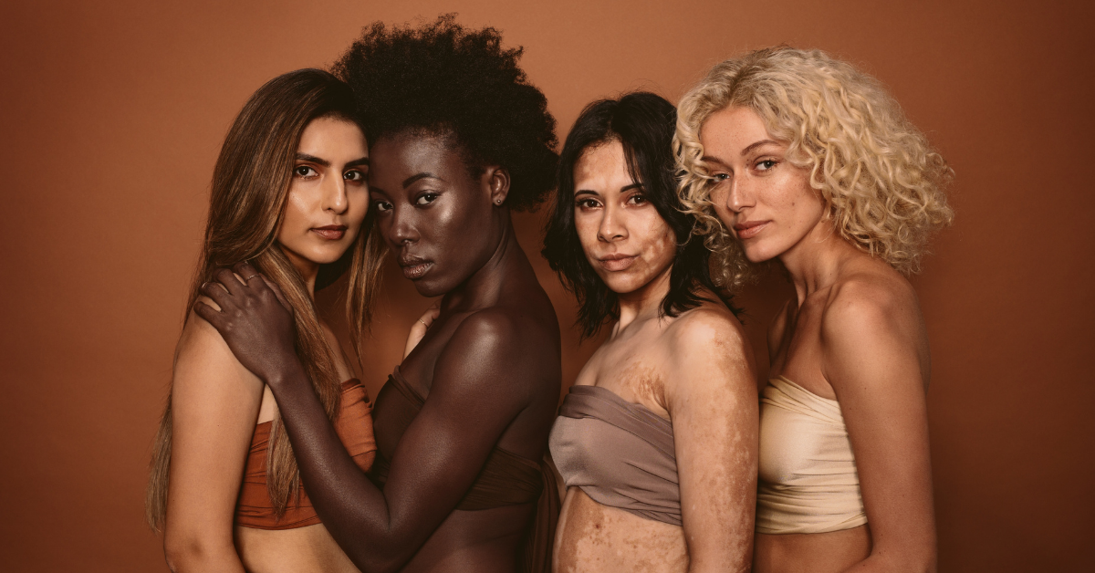 women of different skin colors posing